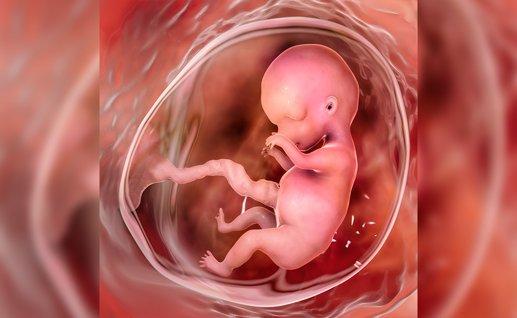 গর্ভের পানি বা এমনিওটিক ফ্লুইড কমে যাওয়ার লক্ষণ, কারণ ও চিকিৎসা