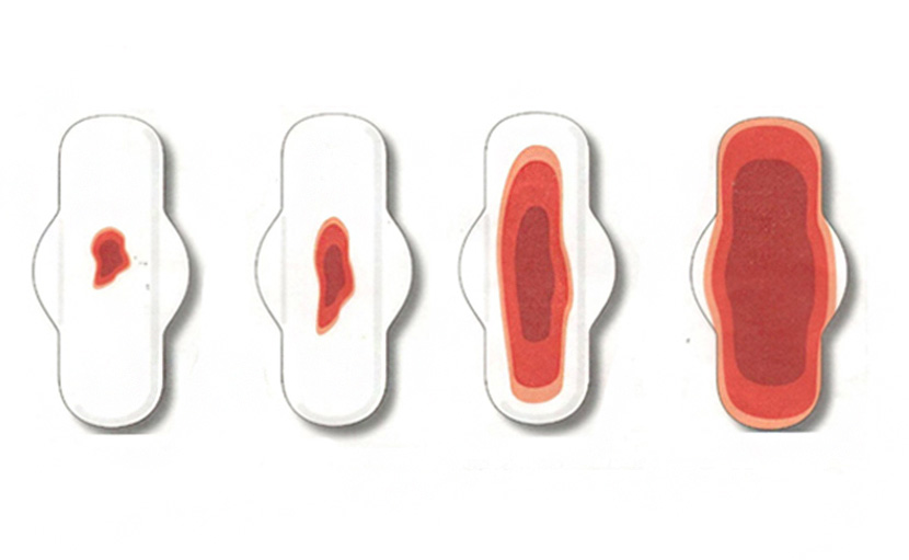 হেভি ব্লিডিং এর কারণ ও স্বাস্থ্যঝুঁকি সম্পর্কে জানেন তো?