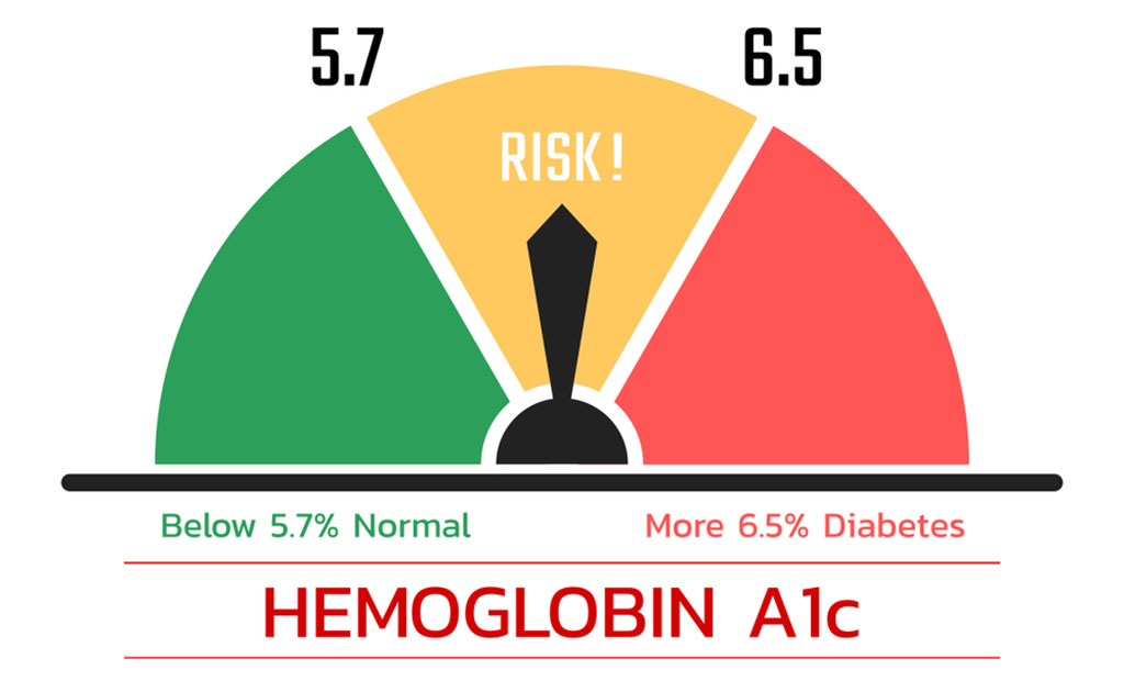 প্রি ডায়াবেটিস এর লক্ষণ এবং ঝুঁকি কমানোর উপায় কী হতে পারে?