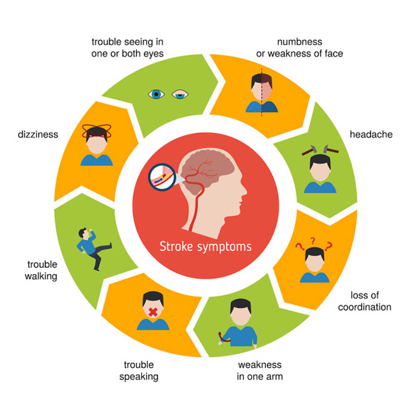 স্ট্রোকের লক্ষণ ও প্রতিরোধ সম্পর্কে গুরুত্বপূর্ণ তথ্যসমূহ জানা আছে কি?